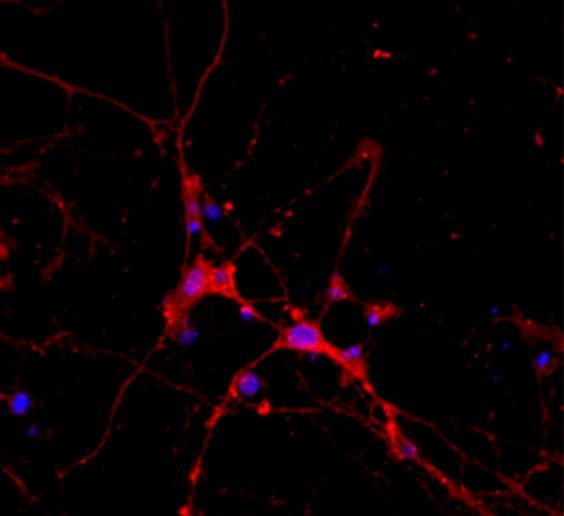 הצטברותם של הננו-חלקיקים בתרבית תאים של נוירונים