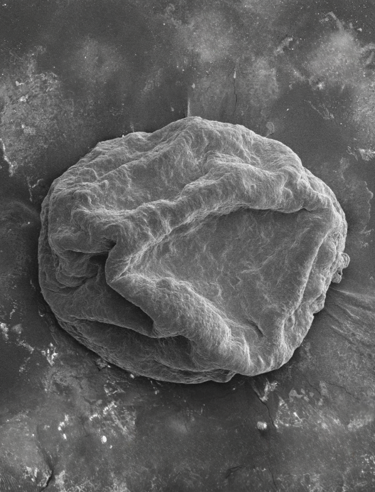 Electron Microscopy Heart.