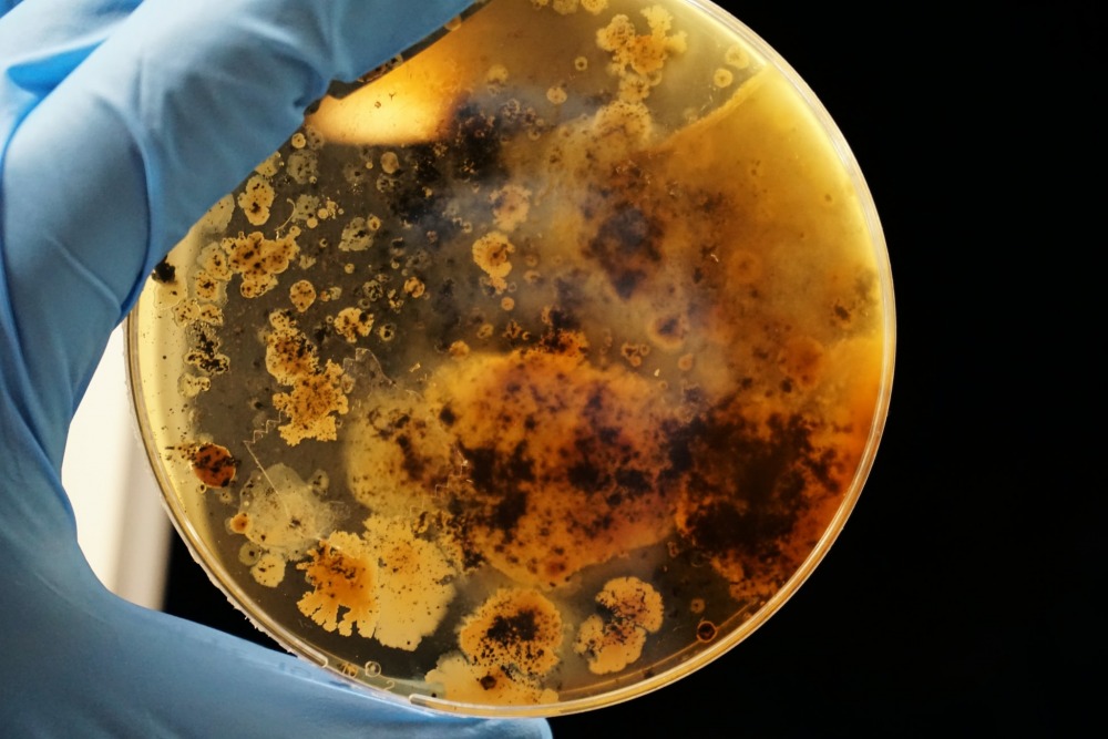 Bacterial colonies grown. Adrian Lange, unsplash.com