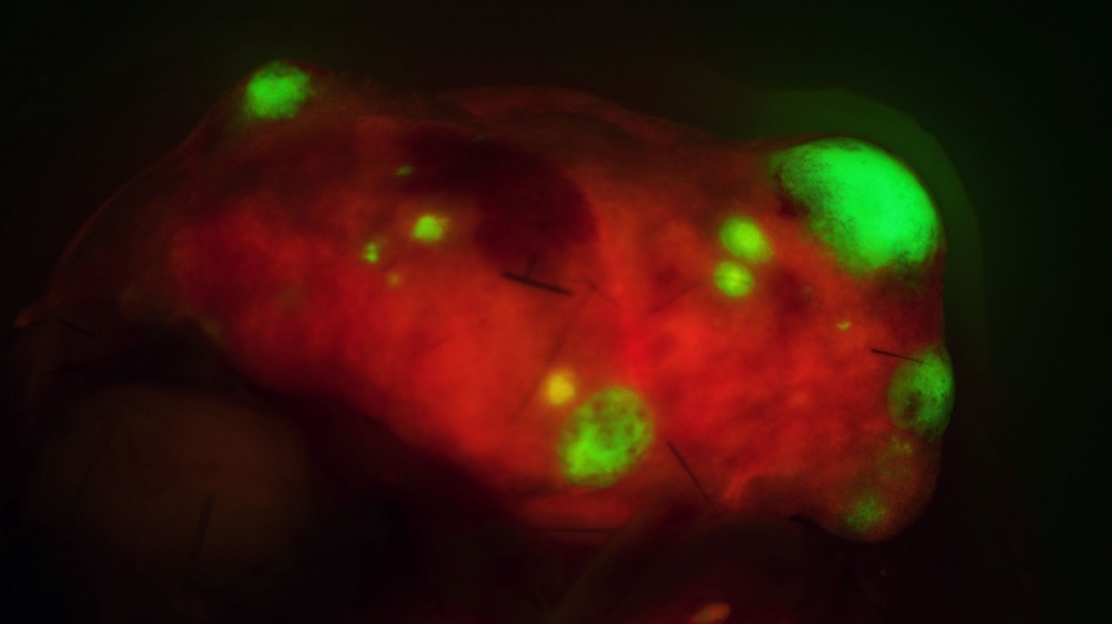 תיאור התמונה המצורפת למייל - אונת ריאות של עכבר עם גרורות תאי סרטן המבטאות חלבון זרחני, כדי לאפשר כימות ומדידת הגרורות. קרדיט - דר אבי מימון