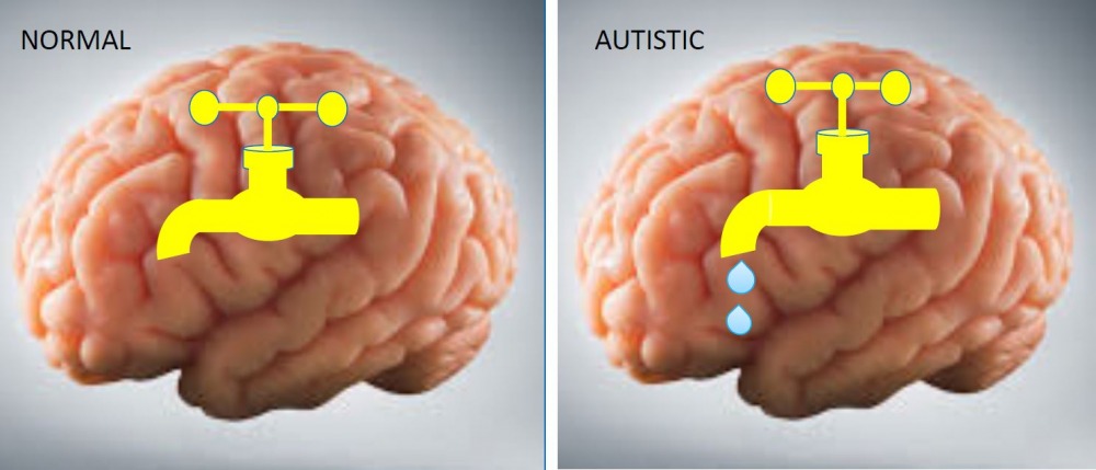timothy syndrome