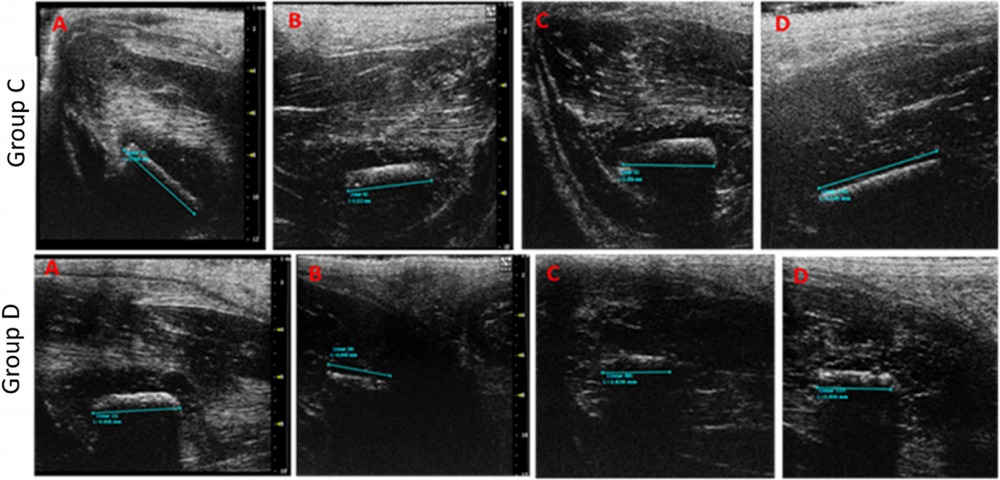 הסמן שהושתל. מתוך הפרסום בכתב העת המדעי ACS applied biomaterials