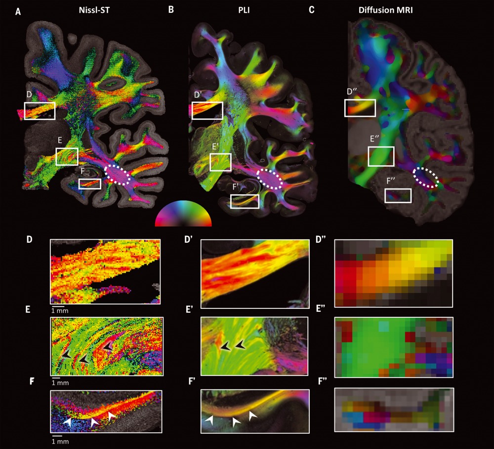 מתוך המחקר עם משרד הבריאות