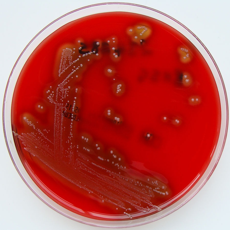 Streptococcus pyogenes A by Nathan Reading
