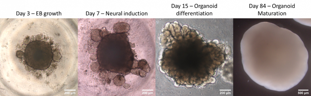 Organoid