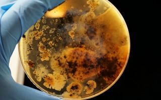 Bacterial colonies grown. Adrian Lange, unsplash.com