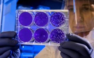  הכנסת חיידקים  ל"מצב כאוטי" כדרך לריפוי מחלות   