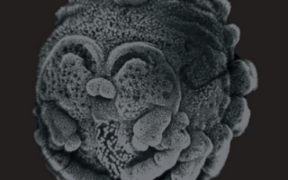 House Spider: Tegenaria pagana embryo, stage 12 | credit: Evgenia Proistova