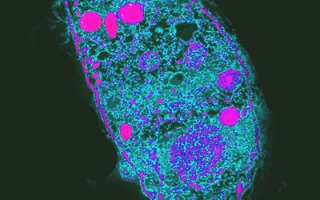 Toxoplasma gondi