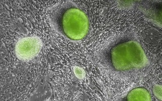 מדענים מאמינים שמצאו את התוכנית הראשונית ביותר ליצירת עובר על ידי יצירת תאי גזע עובריים ושלייתיים מלאכותיים 