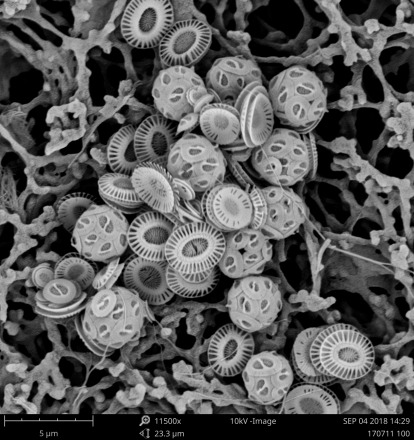 אצות פיטופלנקטון מסוג קוקוליתופורים, דרך מיקרוסקופ אלקטרונים