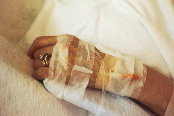 A closeup of a chemotherapy IV in a patient's hand.