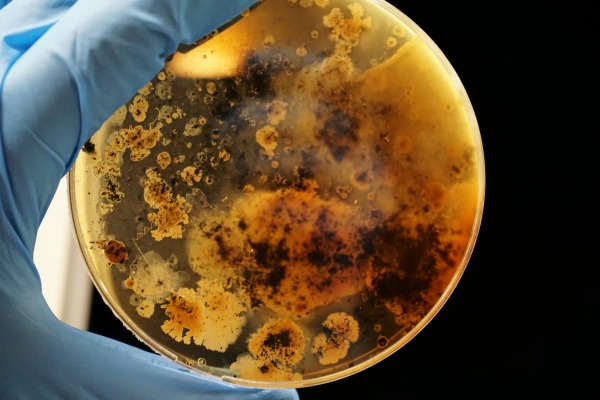 Bacterial colonies grown. Adrian Lange, unsplash.com