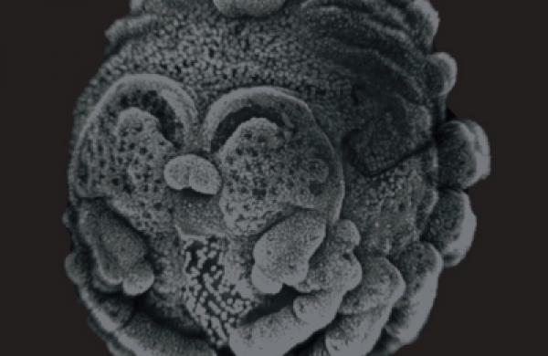 House Spider: Tegenaria pagana embryo, stage 12 | credit: Evgenia Proistova