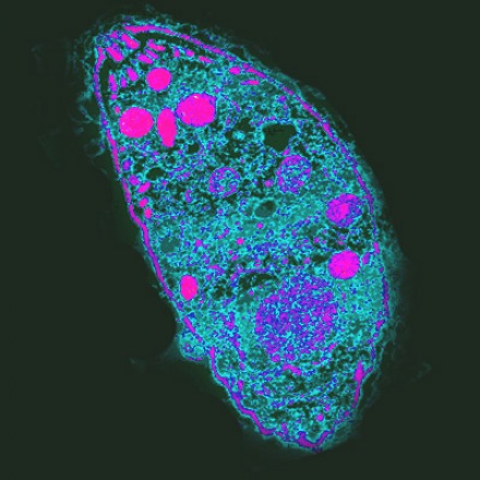 Toxoplasma gondi