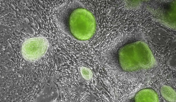 מדענים מאמינים שמצאו את התוכנית הראשונית ביותר ליצירת עובר על ידי יצירת תאי גזע עובריים ושלייתיים מלאכותיים 